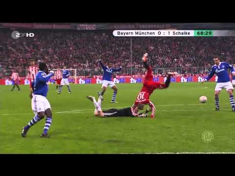 Robben vs Neuer "Bayern München 0-1 Schalke" (DFB-Pokal 02.03.2011) "HD" (Kung Fu Kick)